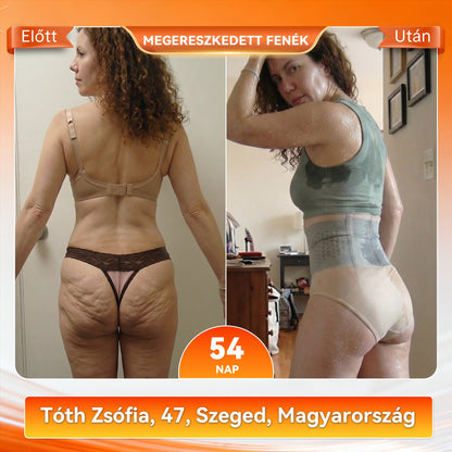 Hivatalos márkabolt |💦 𝐏𝐀𝐔𝐑𝐀𝐉𝐔® 𝟐𝟎𝟐𝟔 𝐌𝐨𝐫𝐢𝐧𝐠𝐚 É𝐬 𝐁𝐞𝐫𝐛𝐞𝐫𝐢𝐧 𝟒 𝐀𝐳 𝟏-𝐁𝐞𝐧 𝐌𝐢𝐤𝐫𝐨𝐫é𝐬𝐳𝐞𝐜𝐬𝐤é𝐬 𝐀𝐥𝐚𝐤𝐟𝐨𝐫𝐦á𝐥ó É𝐬 𝐙𝐬í𝐫é𝐠𝐞𝐭ó 𝐑ö𝐯𝐢𝐝𝐧𝐚𝐝𝐫á𝐠