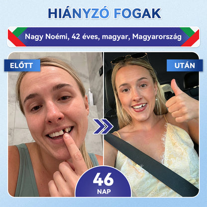 🦷𝐆𝐥𝐢𝐦𝐦𝐞𝐫𝐥𝐲® Tideglusib Fog & íny Javító mikrotűs tapasz | Fejlett őssejt-aktiváló fogcsíkok (újjáépíti a fogzománcot és a dentint • erősíti az ínyt • megszünteti a fogkövet és a szagokat • megállítja a fogérzékenységet)