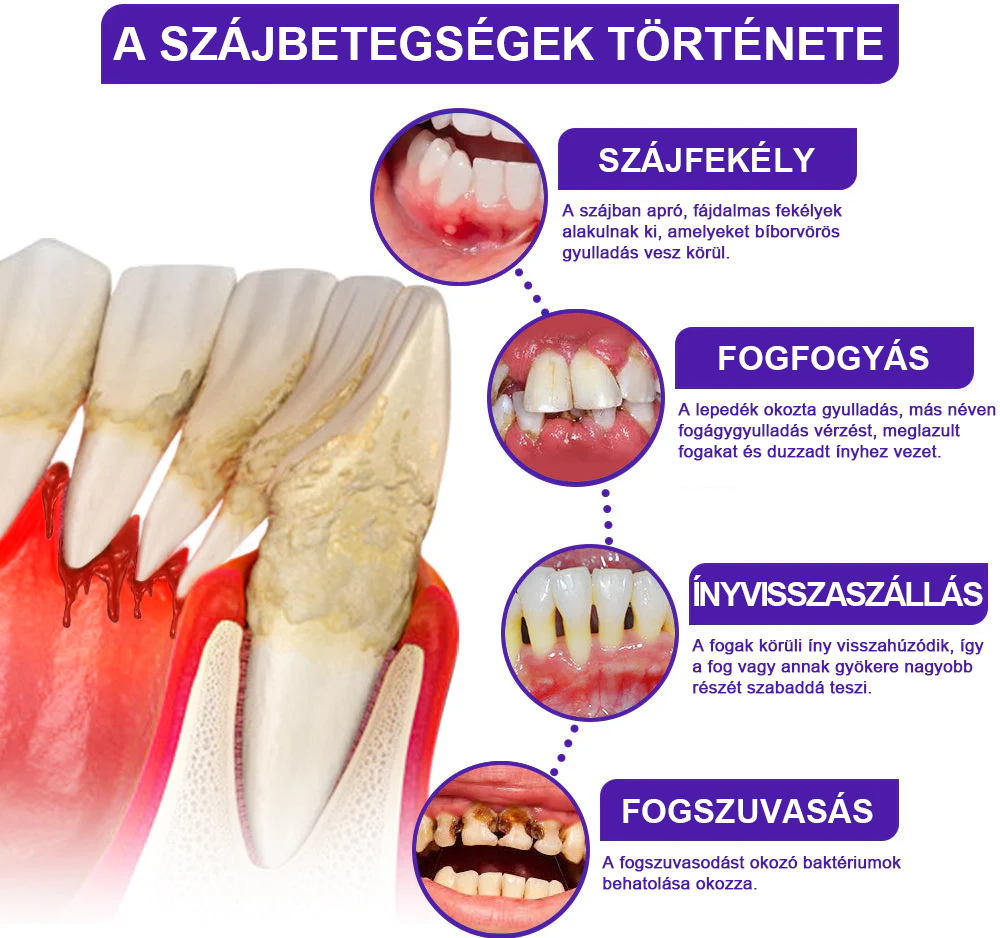 🍅A magyarok kedvence丨Rolimey® VioCore Méhméreg Fogkezelő Fogkrém