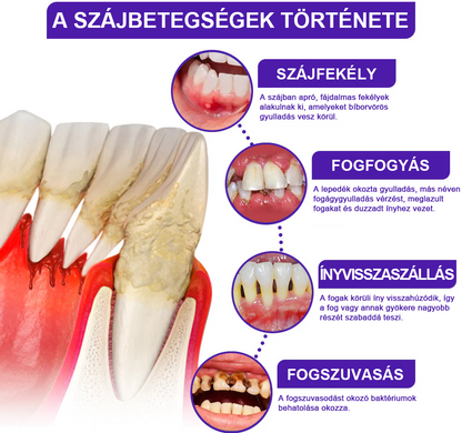 🍅A magyarok kedvence丨Rolimey® VioCore Méhméreg Fogkezelő Fogkrém