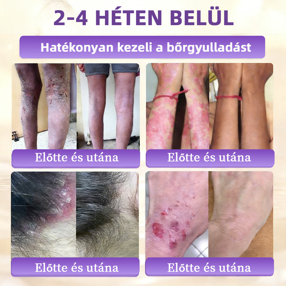 Magyarországról készült és szállított 👩‍⚕️🍉𝐆𝐥𝐢𝐦𝐦𝐞𝐫𝐥𝐲®𝐁𝐈𝐎𝐓𝐈𝐍 𝟏𝟎 𝐀𝐙 𝟏-𝐁𝐄𝐍 𝐁ő𝐫𝐫𝐞𝐠𝐞𝐧𝐞𝐫á𝐥ó 𝐊𝐫é𝐦 🔥