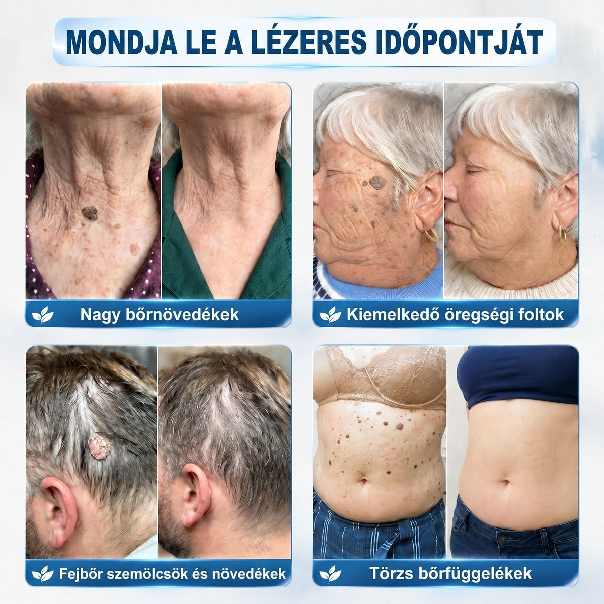 𝐏𝐢𝐜𝐝𝐨® 𝟕 𝐍𝐚𝐩𝐨𝐬 Bőrfolt- és hegápoló eltávolító toll Fájdalommentes használat · Látható nyomok nélkül · Pontos görgős applikátorral 💝