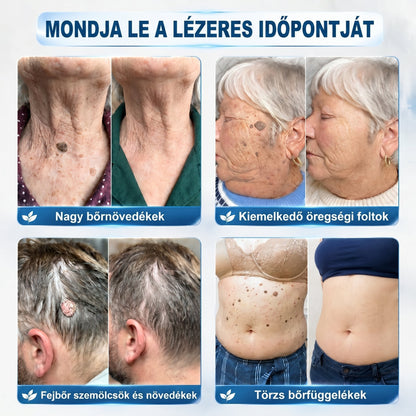 𝐏𝐢𝐜𝐝𝐨® 𝟕 𝐍𝐚𝐩𝐨𝐬 Bőrfolt- és hegápoló eltávolító toll Fájdalommentes használat · Látható nyomok nélkül · Pontos görgős applikátorral 💝