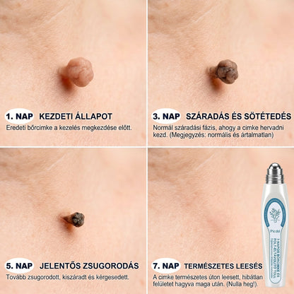 𝐏𝐢𝐜𝐝𝐨® 𝟕 𝐍𝐚𝐩𝐨𝐬 Bőrfolt- és hegápoló eltávolító toll Fájdalommentes használat · Látható nyomok nélkül · Pontos görgős applikátorral 💝