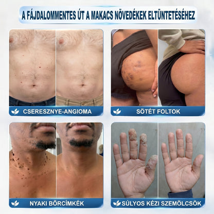 𝐏𝐢𝐜𝐝𝐨® 𝟕 𝐍𝐚𝐩𝐨𝐬 Bőrfolt- és hegápoló eltávolító toll Fájdalommentes használat · Látható nyomok nélkül · Pontos görgős applikátorral 💝