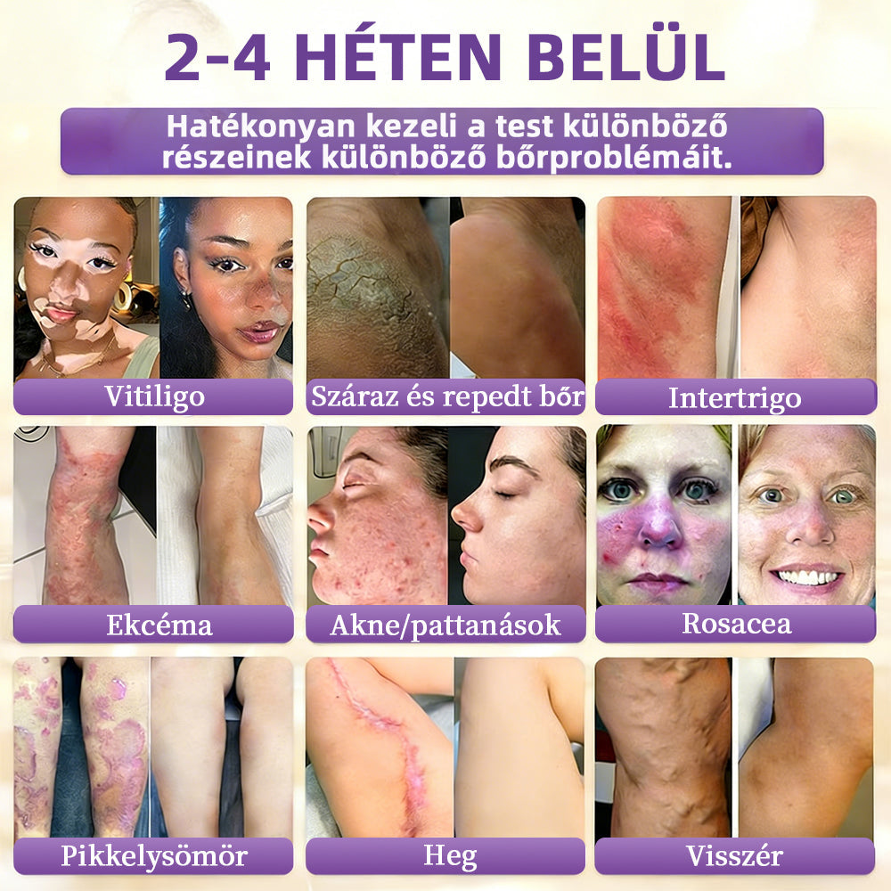 Magyarországról készült és szállított 👩‍⚕️🍉𝐆𝐥𝐢𝐦𝐦𝐞𝐫𝐥𝐲®𝐁𝐈𝐎𝐓𝐈𝐍 𝟏𝟎 𝐀𝐙 𝟏-𝐁𝐄𝐍 𝐁ő𝐫𝐫𝐞𝐠𝐞𝐧𝐞𝐫á𝐥ó 𝐊𝐫é𝐦 🔥