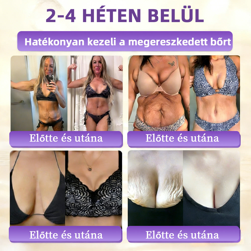 Magyarországról készült és szállított 👩‍⚕️🍉𝐆𝐥𝐢𝐦𝐦𝐞𝐫𝐥𝐲®𝐁𝐈𝐎𝐓𝐈𝐍 𝟏𝟎 𝐀𝐙 𝟏-𝐁𝐄𝐍 𝐁ő𝐫𝐫𝐞𝐠𝐞𝐧𝐞𝐫á𝐥ó 𝐊𝐫é𝐦 🔥