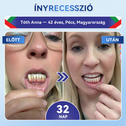 🦷𝐆𝐥𝐢𝐦𝐦𝐞𝐫𝐥𝐲® Tideglusib Fog & íny Javító mikrotűs tapasz | Fejlett őssejt-aktiváló fogcsíkok (újjáépíti a fogzománcot és a dentint • erősíti az ínyt • megszünteti a fogkövet és a szagokat • megállítja a fogérzékenységet)