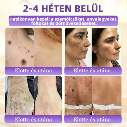 Magyarországról készült és szállított 👩‍⚕️🍉𝐆𝐥𝐢𝐦𝐦𝐞𝐫𝐥𝐲®𝐁𝐈𝐎𝐓𝐈𝐍 𝟏𝟎 𝐀𝐙 𝟏-𝐁𝐄𝐍 𝐁ő𝐫𝐫𝐞𝐠𝐞𝐧𝐞𝐫á𝐥ó 𝐊𝐫é𝐦 🔥
