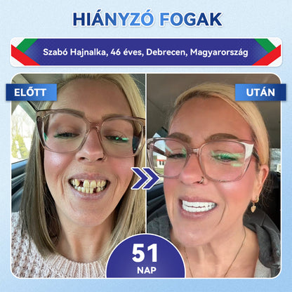 🦷𝐆𝐥𝐢𝐦𝐦𝐞𝐫𝐥𝐲® Tideglusib Fog & íny Javító mikrotűs tapasz | Fejlett őssejt-aktiváló fogcsíkok (újjáépíti a fogzománcot és a dentint • erősíti az ínyt • megszünteti a fogkövet és a szagokat • megállítja a fogérzékenységet)