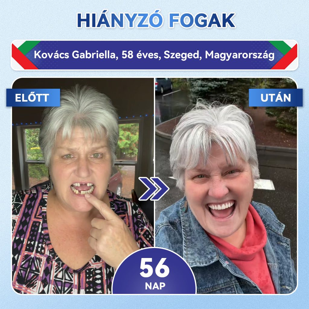 🦷𝐆𝐥𝐢𝐦𝐦𝐞𝐫𝐥𝐲® Tideglusib Fog & íny Javító mikrotűs tapasz | Fejlett őssejt-aktiváló fogcsíkok (újjáépíti a fogzománcot és a dentint • erősíti az ínyt • megszünteti a fogkövet és a szagokat • megállítja a fogérzékenységet)
