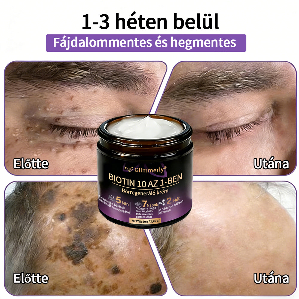 Magyarországról készült és szállított 👩‍⚕️🍉𝐆𝐥𝐢𝐦𝐦𝐞𝐫𝐥𝐲®𝐁𝐈𝐎𝐓𝐈𝐍 𝟏𝟎 𝐀𝐙 𝟏-𝐁𝐄𝐍 𝐁ő𝐫𝐫𝐞𝐠𝐞𝐧𝐞𝐫á𝐥ó 𝐊𝐫é𝐦 🔥