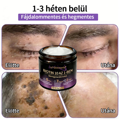 Magyarországról készült és szállított 👩‍⚕️🍉𝐆𝐥𝐢𝐦𝐦𝐞𝐫𝐥𝐲®𝐁𝐈𝐎𝐓𝐈𝐍 𝟏𝟎 𝐀𝐙 𝟏-𝐁𝐄𝐍 𝐁ő𝐫𝐫𝐞𝐠𝐞𝐧𝐞𝐫á𝐥ó 𝐊𝐫é𝐦 🔥