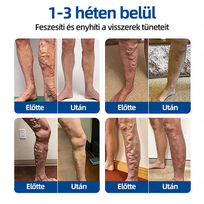 ✅𝐇𝐞𝐚𝐥𝐫𝐢𝐳𝐞® VeinTarget mikrotűs tapasz🍀Azonnali enyhülés hosszú távú eredmények