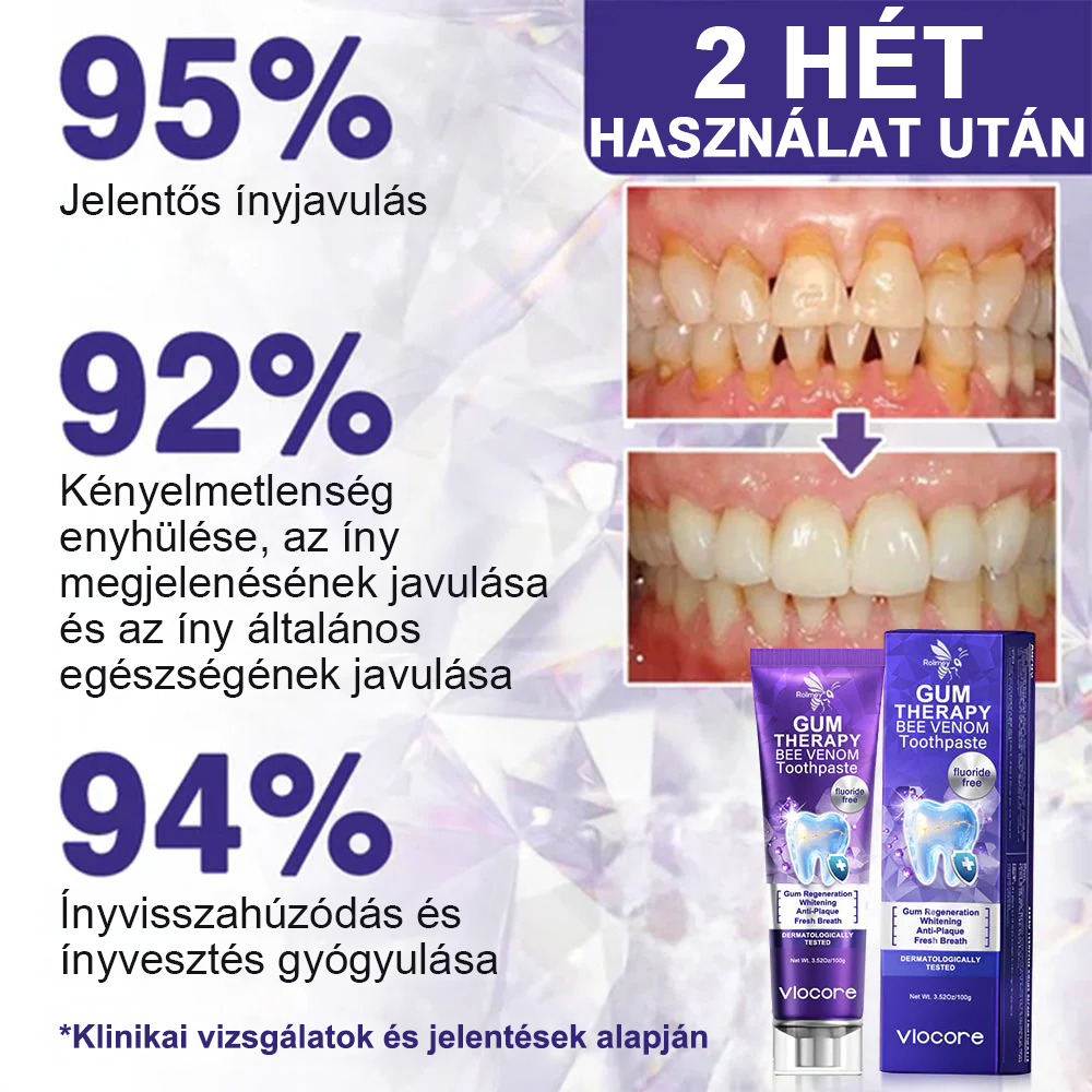 🍅A magyarok kedvence丨Rolimey® VioCore Méhméreg Fogkezelő Fogkrém