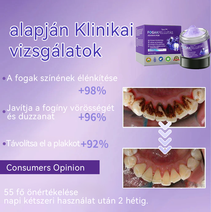 (🔥 Különleges ajánlat utolsó napja - 70% kedvezmény🔥) Spzv™ Fogászati helyreállító ásványi por 🦷 (MOK ajánlásával)