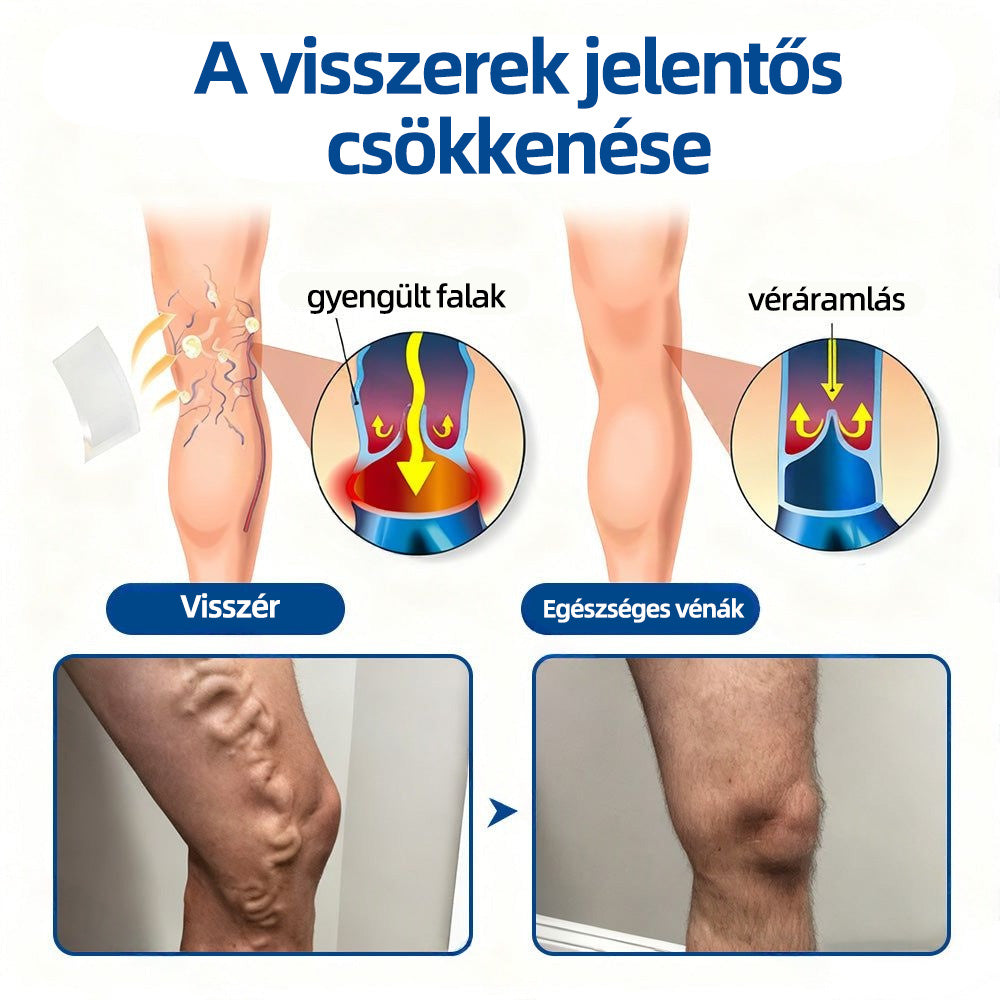✅𝐇𝐞𝐚𝐥𝐫𝐢𝐳𝐞® VeinTarget mikrotűs tapasz🍀Azonnali enyhülés hosszú távú eredmények