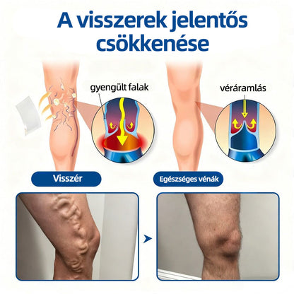 ✅𝐇𝐞𝐚𝐥𝐫𝐢𝐳𝐞® VeinTarget mikrotűs tapasz🍀Azonnali enyhülés hosszú távú eredmények
