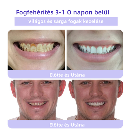 (🔥 Különleges ajánlat utolsó napja - 70% kedvezmény🔥) Spzv™ Fogászati helyreállító ásványi por 🦷 (MOK ajánlásával)