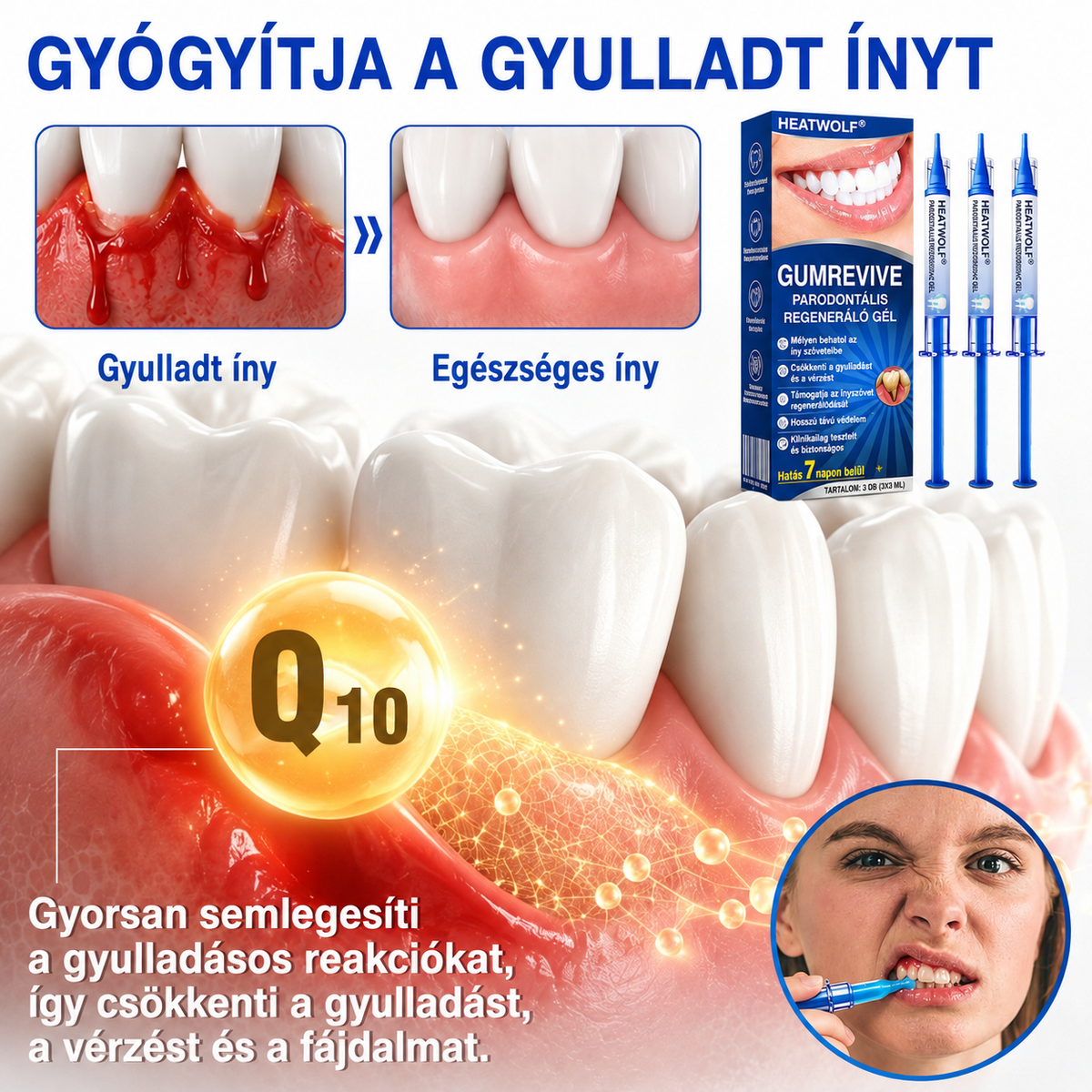 👨‍⚕️✅🦷 HEATWOLF® GumRevive – Parodontális helyreállító gél💞