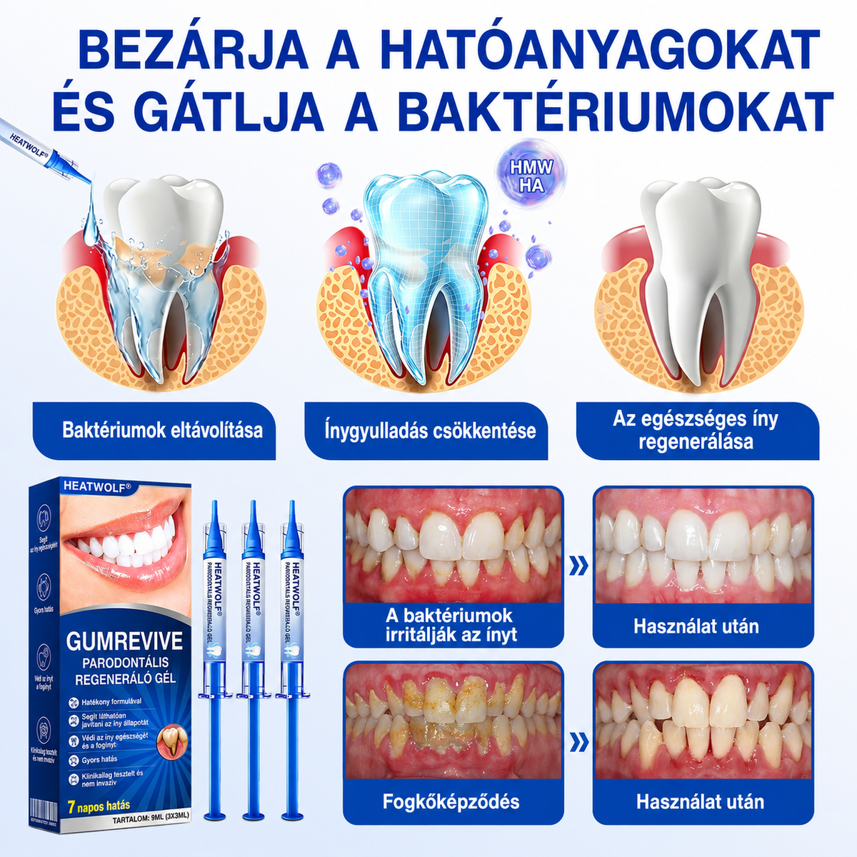 👨‍⚕️✅🦷 HEATWOLF® GumRevive – Parodontális helyreállító gél💞