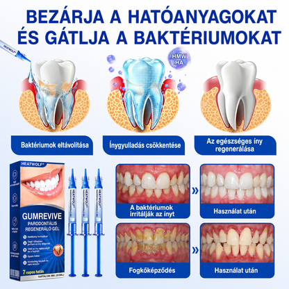 👨‍⚕️✅🦷 HEATWOLF® GumRevive – Parodontális helyreállító gél💞