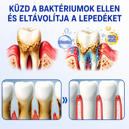 👨‍⚕️✅🦷 HEATWOLF® GumRevive – Parodontális helyreállító gél💞