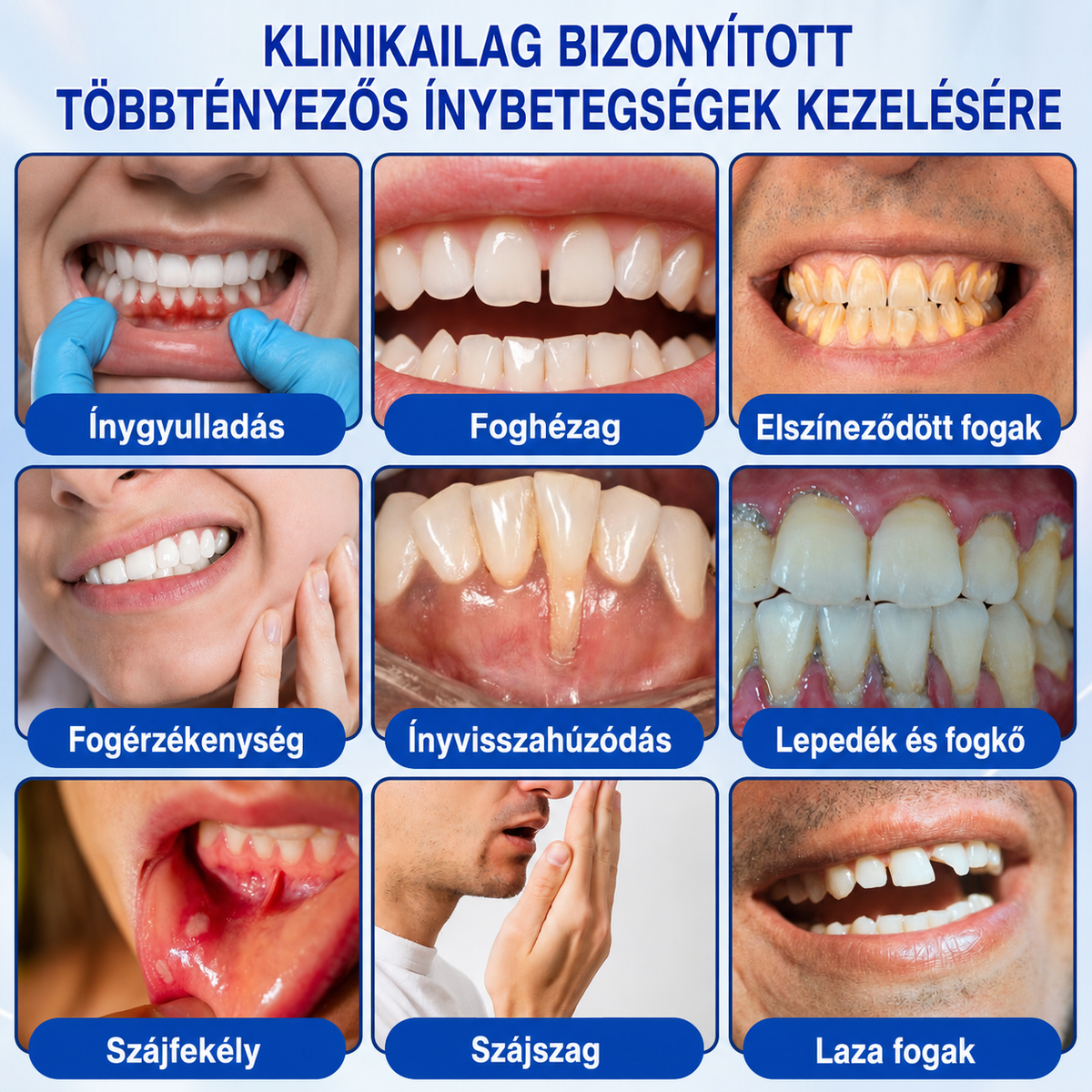 👨‍⚕️✅🦷 HEATWOLF® GumRevive – Parodontális helyreállító gél💞