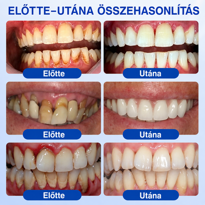 👨‍⚕️✅🦷 HEATWOLF® GumRevive – Parodontális helyreállító gél💞